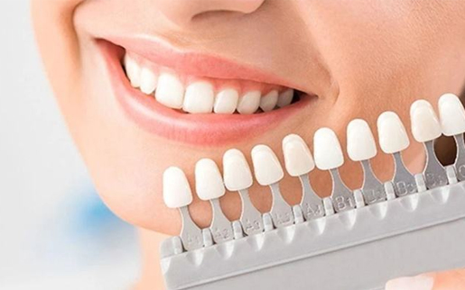 Is tooth whitening the same thing as tooth washing?