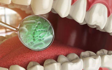 How much do you know about the treatment of periodontal disease?